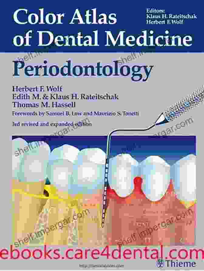 Advanced Periodontal Surgery Color Atlas Of Dental Medicine: Periodontology