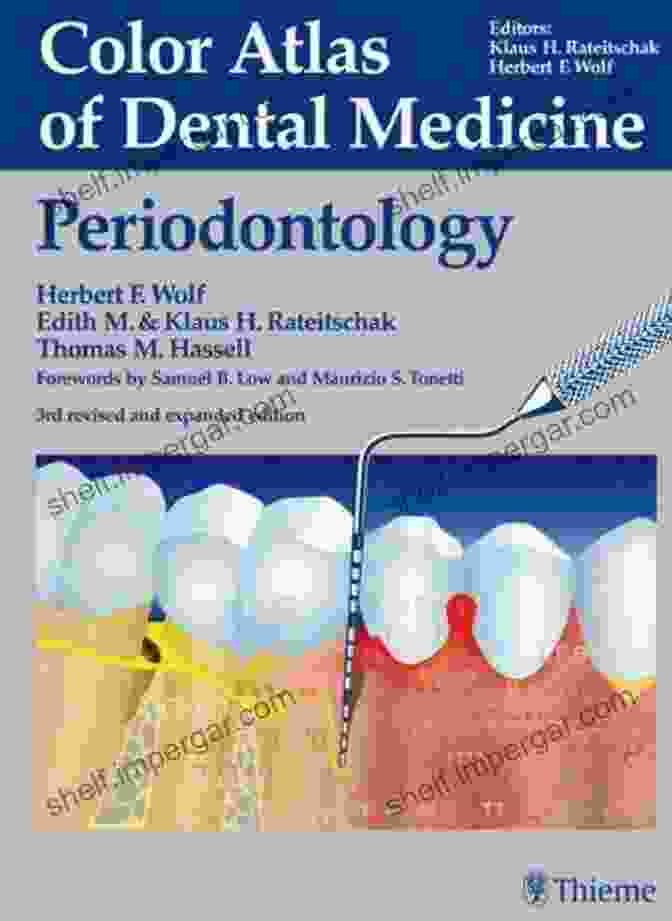 Periodontal Treatment Planning Color Atlas Of Dental Medicine: Periodontology