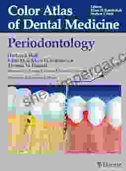 Color Atlas Of Dental Medicine: Periodontology